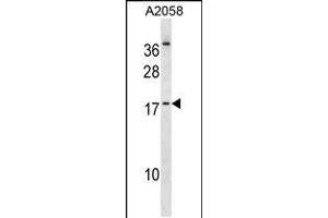 Western blot analysis in A2058 cell line lysates (35ug/lane). (NHLH2 抗体  (AA 63-91))