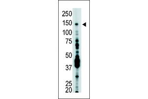 Antibody is used in Western blot to detect USP7 in T-47D cell lysate. (USP7 抗体  (C-Term))