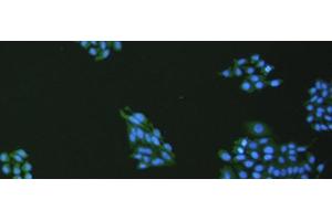 Immunofluorescence analysis of hepG2 cell using VNN1 Polyclonal Antibody at dilution of 1:100 (VNN1 抗体)