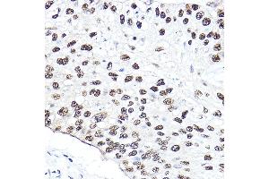 Immunohistochemistry (IHC) image for anti-Nibrin (NBN) (AA 435-754) antibody (ABIN1681204)