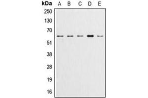 Western blot analysis of AKT (pY315) expression in HeLa (A), A549 (B), LOVO (C), HepG2 (D), NIH3T3 (E) whole cell lysates. (AKT1 抗体  (pTyr315))