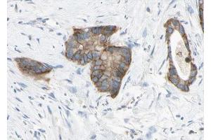 ABIN6268761 at 1/100 staining human liver tissue sections by IHC-P. (Claudin 6 抗体  (Internal Region))