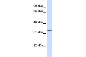 WB Suggested Anti-MRPS15 Antibody Titration: 0. (MRPS15 抗体  (Middle Region))