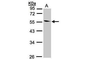 WB Image Sample(30 ug whole cell lysate) A:293T 10% SDS PAGE antibody diluted at 1:1000 (CORO1B 抗体)