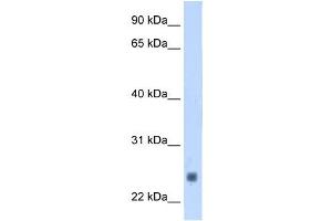 Troponin I Type 2 antibody used at 1. (TNNI2 抗体)