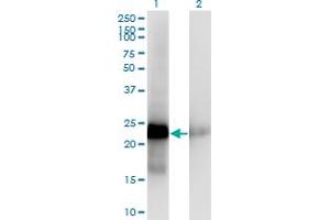 Western Blot analysis of CITED1 expression in transfected 293T cell line by CITED1 monoclonal antibody (M03), clone 5H6.