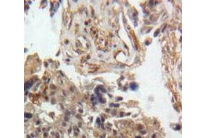 Used in DAB staining on fromalin fixed paraffin-embedded Ovary tissue (GDF9 抗体  (AA 307-441))