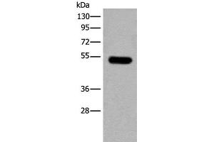 Western blot analysis of Mouse brain tissue lysate using CDKL2 Polyclonal Antibody at dilution of 1:250 (CDKL2 抗体)