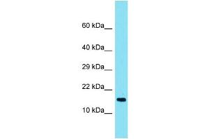 Host: Rabbit Target Name: TMEM190 Sample Type: Fetal Heart lysates Antibody Dilution: 1. (TMEM190 抗体  (C-Term))