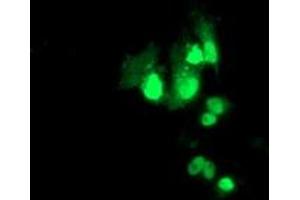 Anti-PBX1 mouse monoclonal antibody (ABIN2454629) immunofluorescent staining of COS7 cells transiently transfected by pCMV6-ENTRY PBX1 (RC210944). (PBX1 抗体)