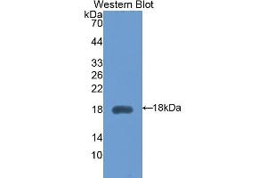 Detection of Recombinant HEXb, Mouse using Polyclonal Antibody to Hexosaminidase B Beta (HEXb) (HEXB 抗体  (AA 294-435))