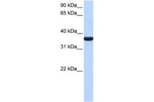 Western Blotting (WB) image for anti-Tumor Protein P53 Inducible Protein 13 (TP53I13) antibody (ABIN2463454) (TP53I13 抗体)