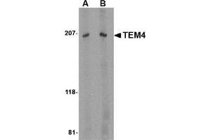 Western blot analysis of TEM4 in Jurkat Cell lysate with this product at (A) 1 and (B) 2 μg/ml. (ARHGEF17 抗体  (Center))