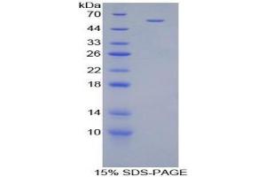SDS-PAGE analysis of Mouse CILP Protein. (CILP 蛋白)