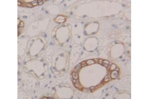 IHC-P analysis of Human Tissue, with DAB staining. (AP2M1 抗体  (AA 170-435))