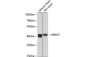 Western blot analysis of extracts of various cell lines, using UBI antibody (ABIN6134946, ABIN6149845, ABIN6149848 and ABIN6223555) at 1:1000 dilution. (UBIAD1 抗体  (AA 1-100))