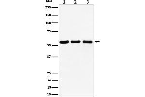 Western blot analysis of PRPF4 expression in (1) Raji cell lysate, (2) RAW 264.