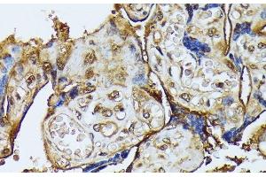 Immunohistochemistry of paraffin-embedded Human placenta using DAPK3 Polyclonal Antibody at dilution of 1:100 (40x lens). (DAPK3 抗体)