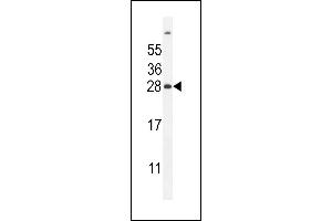 FAT10 Antibody (C-term) (ABIN655263 and ABIN2837857) western blot analysis in mouse liver tissue lysates (35 μg/lane). (UBD 抗体  (C-Term))