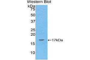 Western Blotting (WB) image for anti-Angiopoietin-Like 4 (ANGPTL4) (AA 286-409) antibody (ABIN1174062) (ANGPTL4 抗体  (AA 286-409))