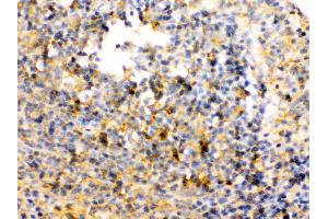 TRIB2 was detected in paraffin-embedded sections of rat spleen tissues using rabbit anti- TRIB2 Antigen Affinity purified polyclonal antibody at 1 μg/mL. (TRIB2 抗体  (Middle Region))