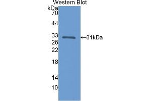 Detection of Recombinant CALB, Rat using Polyclonal Antibody to Calbindin (CALB) (CALB1 抗体  (AA 2-261))