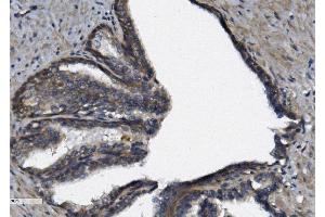 IHC analysis of AFAP/AFAP1 using anti-AFAP/AFAP1 antibody (ABIN7601861).