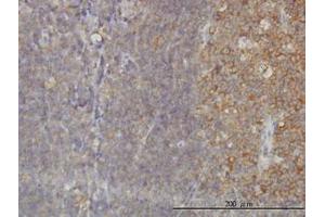 Image no. 1 for anti-RAB21, Member RAS Oncogene Family (RAB21) (AA 116-226) antibody (ABIN599189) (RAB21 抗体  (AA 116-226))