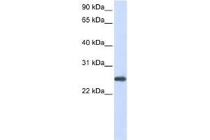 PRDX1 antibody used at 1 ug/ml to detect target protein. (Peroxiredoxin 1 抗体  (N-Term))