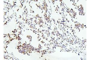 IHC analysis of DCC using anti-DCC antibody (ABIN7602566).