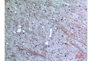 Immunohistochemistry (IHC) analysis of paraffin-embedded Rat Brain, antibody was diluted at 1:100. (CCL26 抗体  (Internal Region))