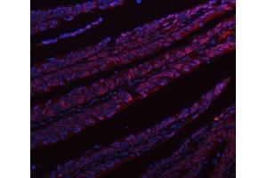 IF analysis of hnRNP L/HNRNPL using anti-hnRNP L/HNRNPL antibody (ABIN7600130).