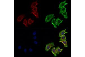 anti-Neutral Cholesterol Ester Hydrolase 1 (NCEH1) (N-Term) antibody