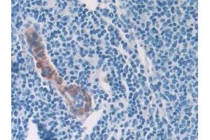 Immunohistochemistry (IHC) image for anti-Collagen, Type II, alpha 1 (COL2A1) (AA 1307-1383) antibody (ABIN7438682)