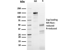 SDS-PAGE Analysis Purified Tubulin beta 3 Mouse Monoclonal Antibody (TUBB3/3731). (TUBB3 抗体  (AA 437-450))