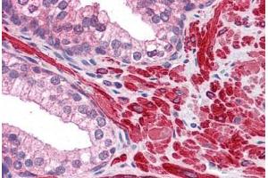 Human Prostate: Formalin-Fixed, Paraffin-Embedded (FFPE) (DPP8 抗体  (AA 1-39))
