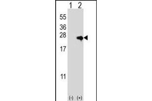 Western blot analysis of NME4 (arrow) using rabbit polyclonal NME4 Antibody (M1) (ABIN392784 and ABIN2842222). (NME4 抗体  (N-Term))