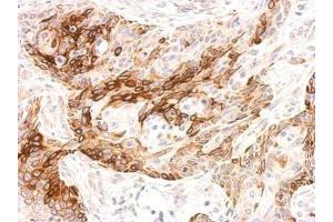 IHC-P Image Galanin Receptor 2 antibody detects GALR2 protein at membrane on Cal27 xenograft by immunohistochemical analysis. (GALR2 抗体  (C-Term))