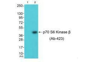 Western blot analysis of extracts from 3T3 cells (Lane 2), using p70 S6 Kinase β (Ab-423) antiobdy. (RPS6KB2 抗体  (Ser423))
