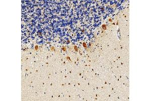 IHC analysis of RPS17 using anti-RPS17 antibody (ABIN7598984).