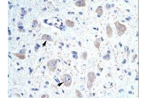 Image no. 1 for anti-Kv Channel Interacting Protein 1 (KCNIP1) (N-Term) antibody (ABIN202072) (KCNIP1 抗体  (N-Term))