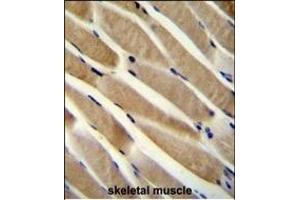 TRIM7 Antibody (N-term) (ABIN655918 and ABIN2845317) immunohistochemistry analysis in formalin fixed and paraffin embedded human skeletal muscle followed by peroxidase conjugation of the secondary antibody and DAB staining. (TRIM7 抗体  (N-Term))