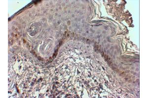 AP31562PU-N (2 µg/ml) staining of paraffin embedded Human Skin. (CMA1 抗体  (Internal Region))