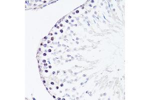 Immunohistochemistry of paraffin-embedded rat testis using FGF12 antibody (ABIN3016419, ABIN3016420, ABIN1679841 and ABIN6219744) at dilution of 1:150 (40x lens). (FGF12 抗体  (AA 1-181))