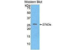 Detection of Recombinant ELN, Human using Polyclonal Antibody to Elastin (ELN) (Elastin 抗体  (AA 392-645))