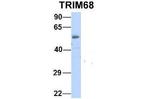 Host:  Rabbit  Target Name:  TRIM68  Sample Type:  Human Fetal Heart  Antibody Dilution:  1. (TRIM68 抗体  (Middle Region))
