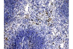 IHC analysis of Caspase8 using anti-Caspase8 antibody . (Caspase 8 抗体  (N-Term))