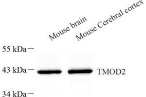 Western blot analysis of TMOD2 (ABIN7076027) at dilution of 1: 500 (TMOD2 抗体)