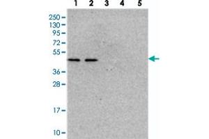 Western blot analysis of Lane 1: RT-4, Lane 2: U-251 MG, Lane 3: Human Plasma, Lane 4: Liver, Lane 5: Tonsil with NSUN6 polyclonal antibody  at 1:250-1:500 dilution. (NSUN6 抗体)
