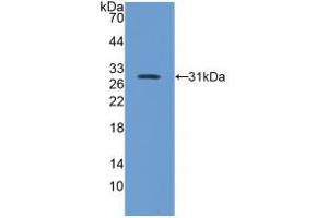 Western blot analysis of recombinant Mouse ITGb5. (Integrin beta 5 抗体  (AA 136-378))